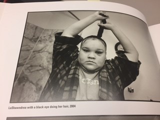 khadija-tiny-screening-black-eye